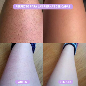 DEBLAST™ Depilador Corporal - ¡Sin vello corporal con una pasada!